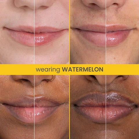 Rescue Lip Relief