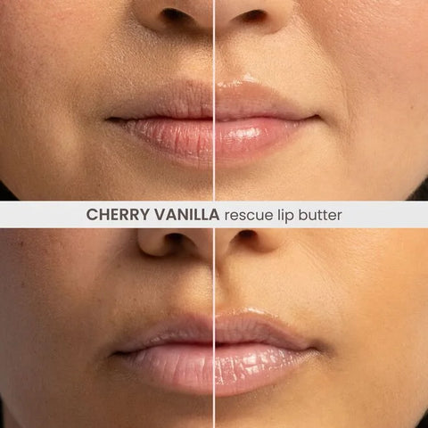 Rescue Lip Butter - Cherry Vanilla